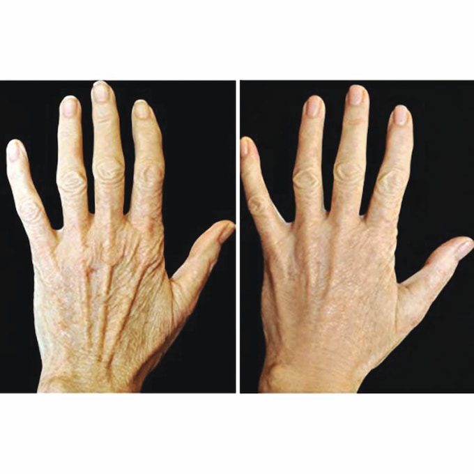 Crepe Gone Facial Souffle Anti-Aging Skin Cream, , large