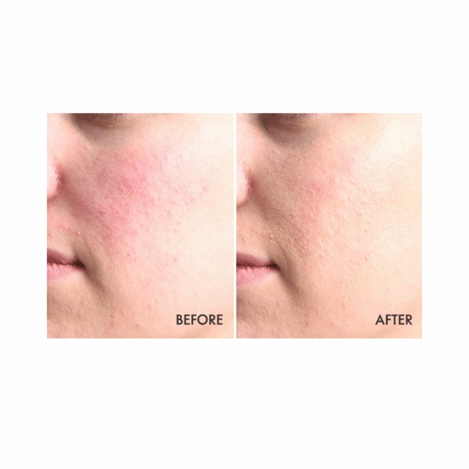 Red Away Anti-Redness Night Treatment, , large