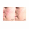 Red Away Anti-Redness Night Treatment, , large