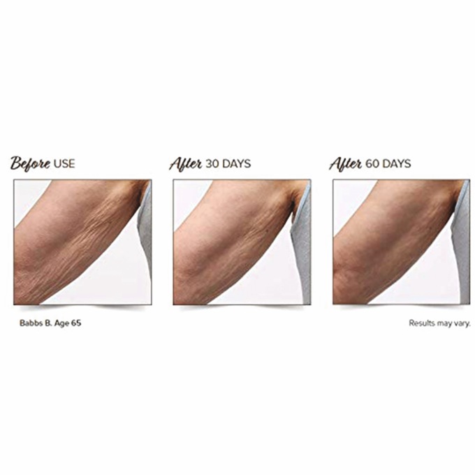 Crepe Gone Facial Souffle Anti-Aging Skin Cream, , large