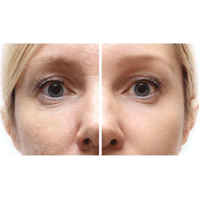 Timeless Beauty Hydrogel Eye Patches, , large