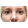 Timeless Beauty Hydrogel Eye Patches, , large